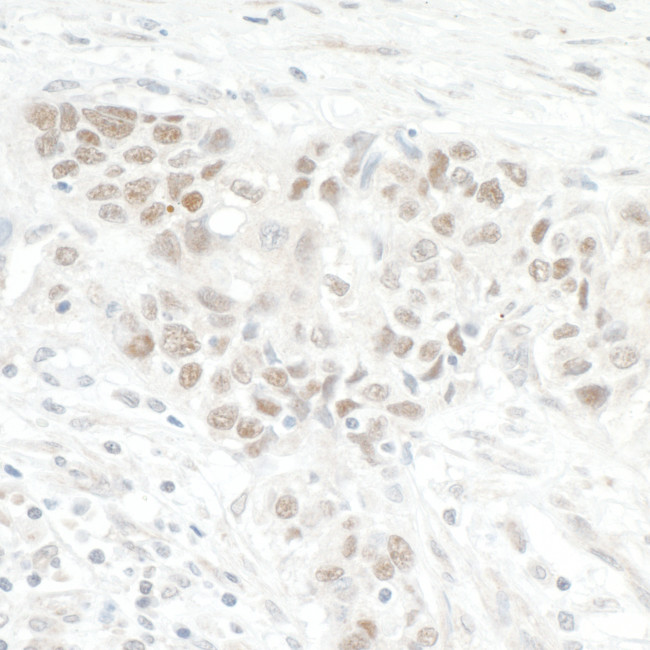 NOL12 Antibody in Immunohistochemistry (Paraffin) (IHC (P))