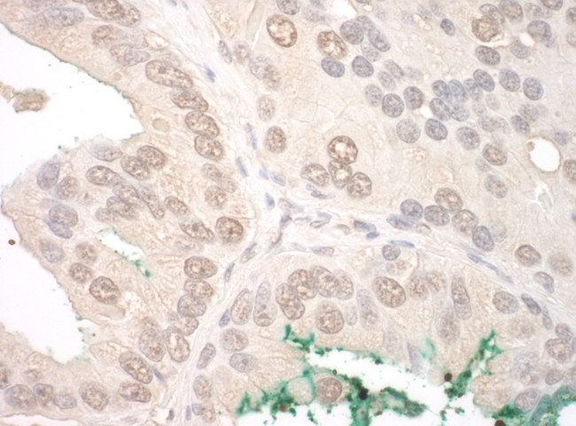 ORC2 Antibody in Immunohistochemistry (Paraffin) (IHC (P))