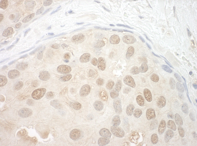 ORC2 Antibody in Immunohistochemistry (Paraffin) (IHC (P))