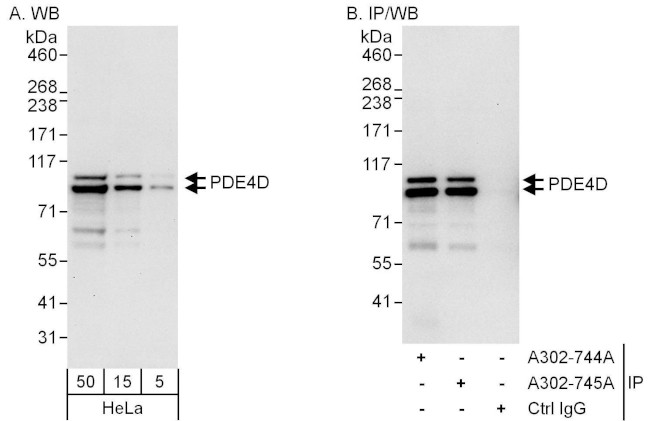 PDE4D Antibody in Western Blot (WB)