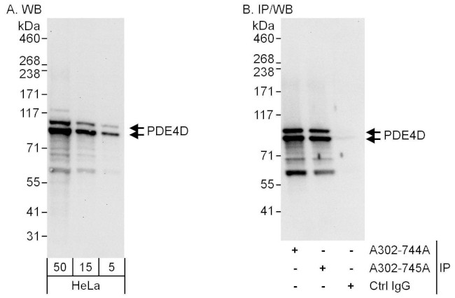 PDE4D Antibody in Western Blot (WB)