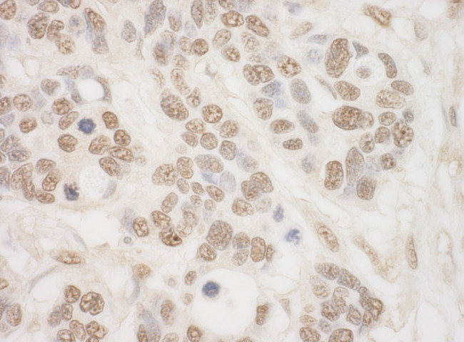 MSK2 Antibody in Immunohistochemistry (Paraffin) (IHC (P))