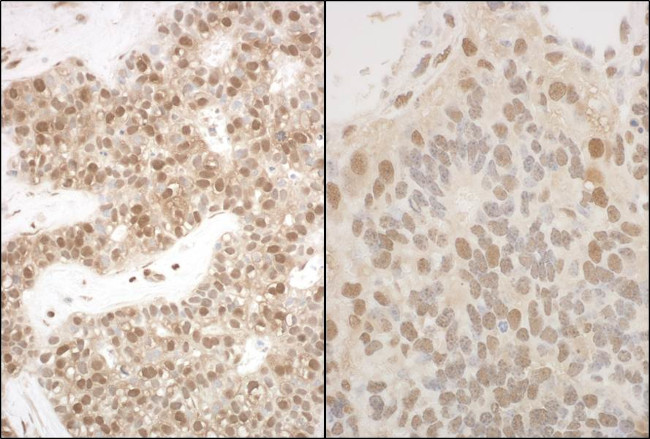PSMA5 Antibody in Immunohistochemistry (Paraffin) (IHC (P))