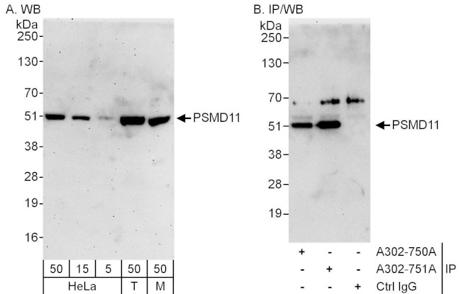 PSMD11 Antibody in Western Blot (WB)