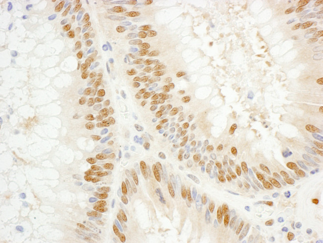 GTF2E1/TFIIE-alpha Antibody in Immunohistochemistry (Paraffin) (IHC (P))
