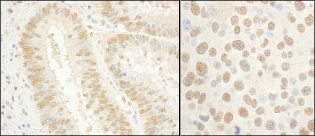 GTF2E1/TFIIE-alpha Antibody in Immunohistochemistry (Paraffin) (IHC (P))