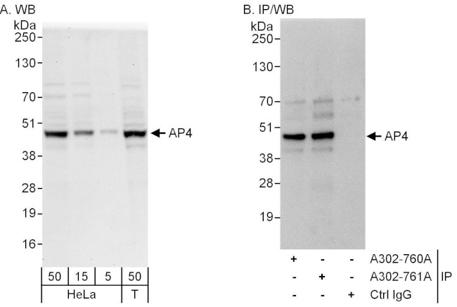 AP4 Antibody in Western Blot (WB)