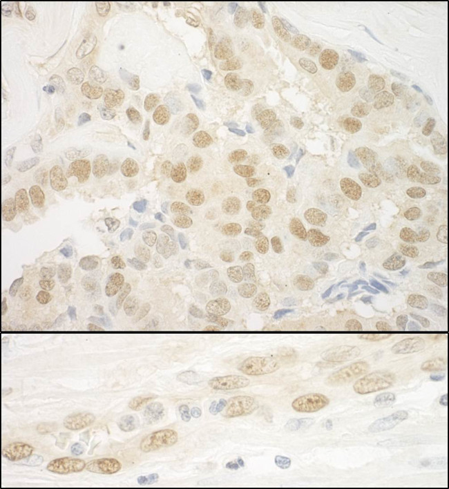 MKL2 Antibody in Immunohistochemistry (Paraffin) (IHC (P))
