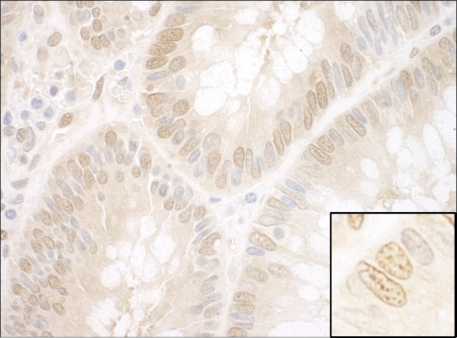 NPAT Antibody in Immunohistochemistry (Paraffin) (IHC (P))