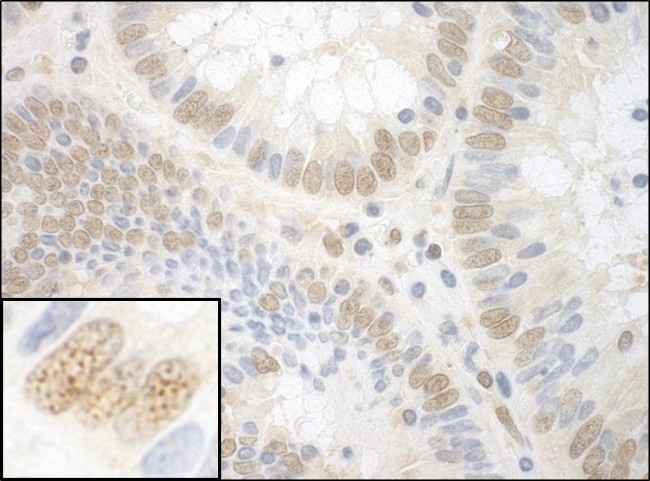 NPAT Antibody in Immunohistochemistry (Paraffin) (IHC (P))