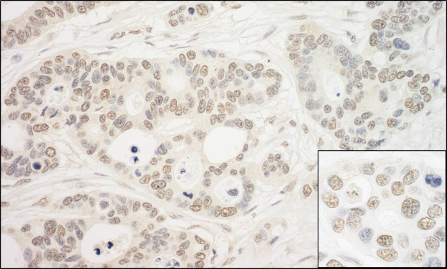 PRP6 Antibody in Immunohistochemistry (Paraffin) (IHC (P))