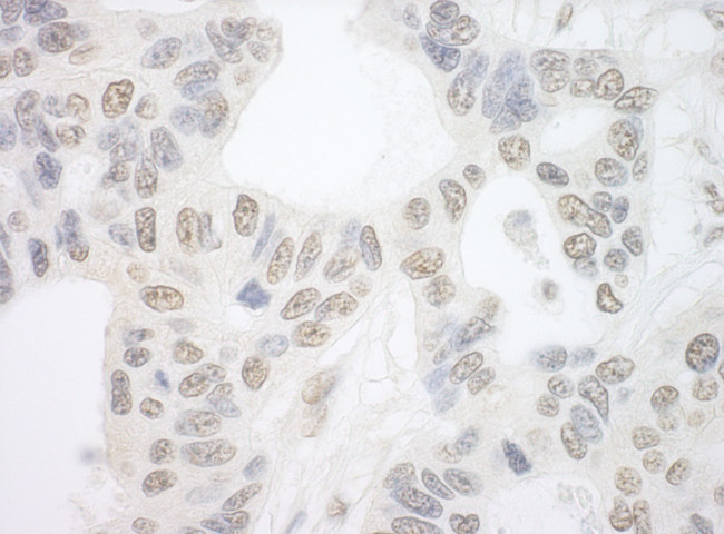 PRP6 Antibody in Immunohistochemistry (Paraffin) (IHC (P))