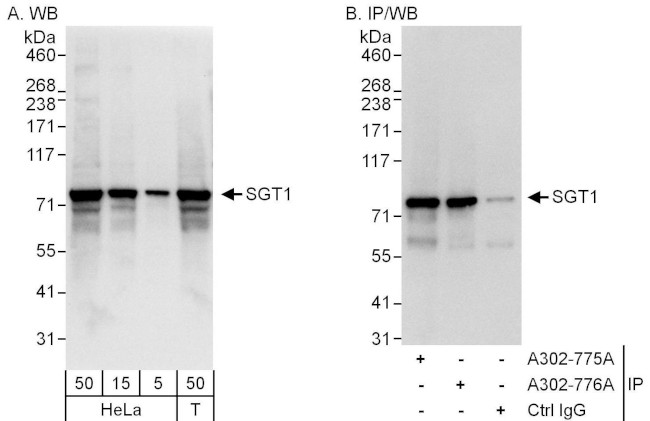 GCR2/SGT1 Antibody in Western Blot (WB)