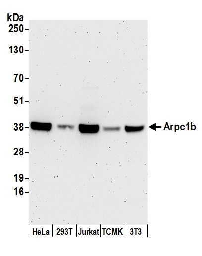 Arpc1b Antibody in Western Blot (WB)