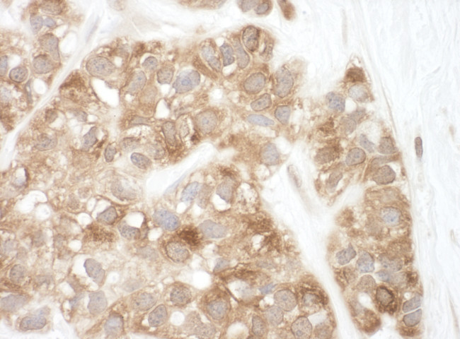 AIF Antibody in Immunohistochemistry (Paraffin) (IHC (P))