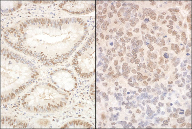 PQBP1 Antibody in Immunohistochemistry (Paraffin) (IHC (P))