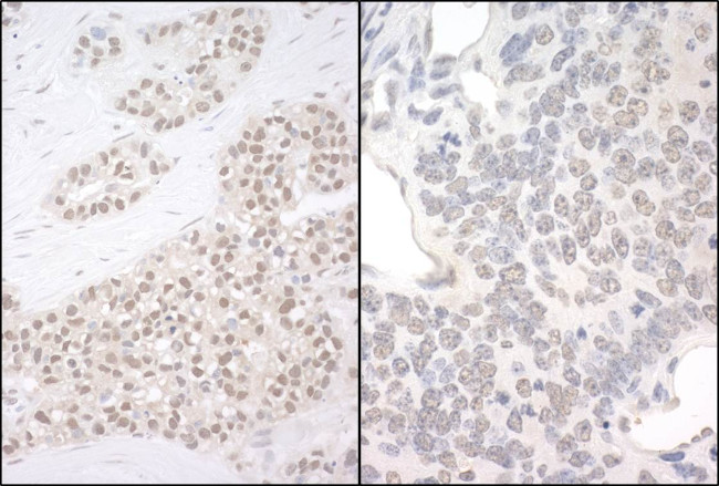 PQBP1 Antibody in Immunohistochemistry (Paraffin) (IHC (P))