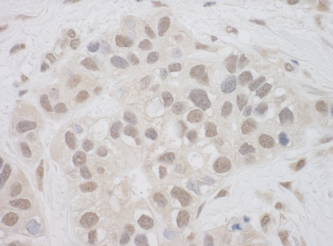 SUPT7L Antibody in Immunohistochemistry (Paraffin) (IHC (P))