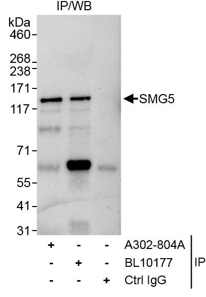 SMG5 Antibody in Immunoprecipitation (IP)
