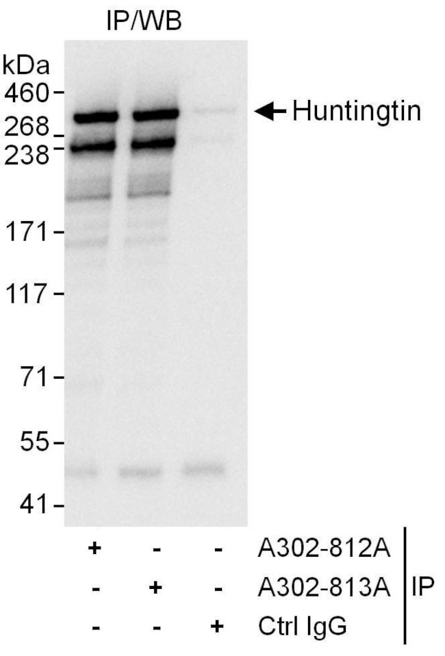 Huntingtin Antibody in Immunoprecipitation (IP)