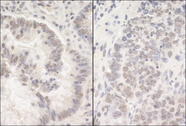 PUF60 Antibody in Immunohistochemistry (Paraffin) (IHC (P))