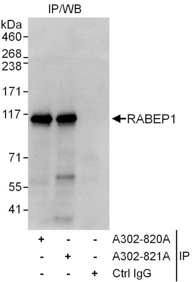 RABEP1 Antibody in Immunoprecipitation (IP)