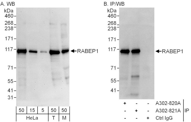 RABEP1 Antibody in Western Blot (WB)