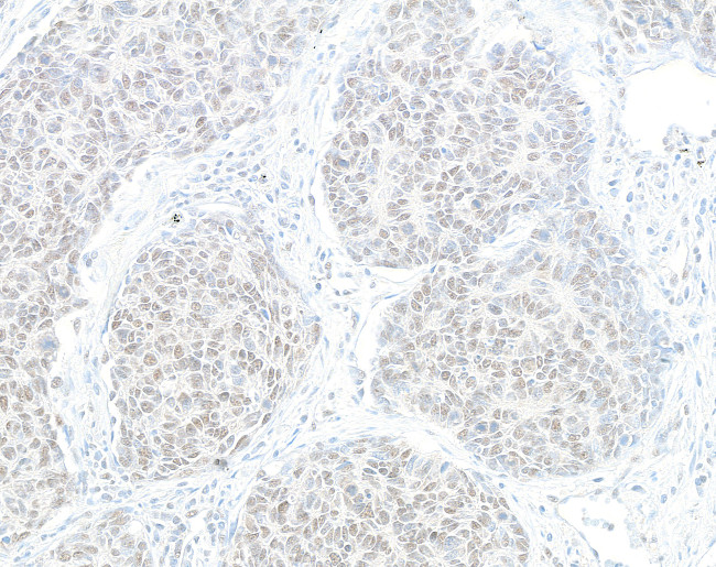 HJURP Antibody in Immunohistochemistry (Paraffin) (IHC (P))