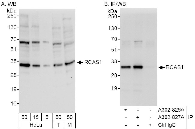RCAS1 Antibody in Western Blot (WB)