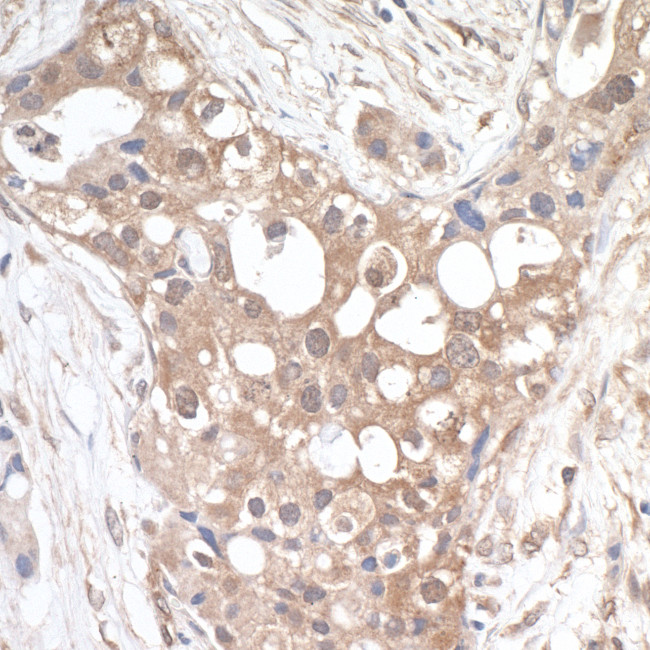 PTPIP51 Antibody in Immunohistochemistry (Paraffin) (IHC (P))