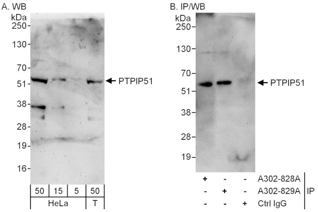 PTPIP51 Antibody in Western Blot (WB)