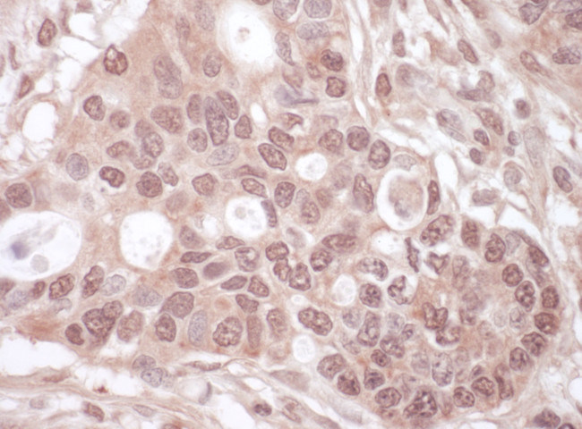THOC1 Antibody in Immunohistochemistry (Paraffin) (IHC (P))