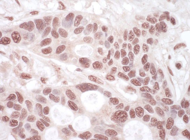 THOC1 Antibody in Immunohistochemistry (Paraffin) (IHC (P))