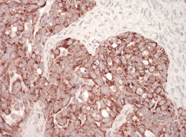 HSP60 Antibody in Immunohistochemistry (Paraffin) (IHC (P))