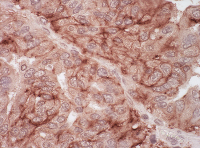 CAR Antibody in Immunohistochemistry (Paraffin) (IHC (P))