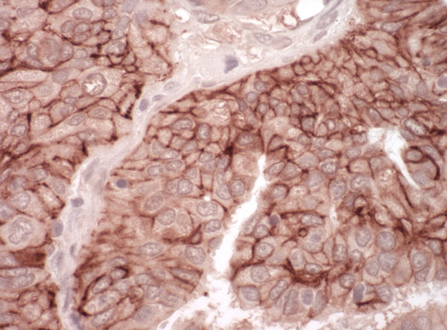 CAR Antibody in Immunohistochemistry (Paraffin) (IHC (P))