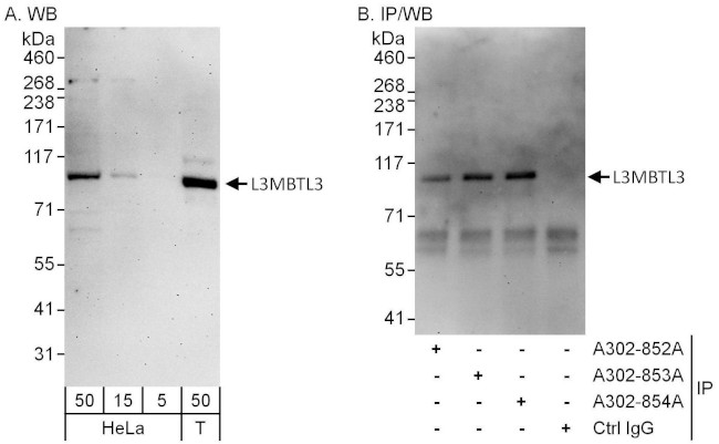 L3MBTL3 Antibody in Western Blot (WB)