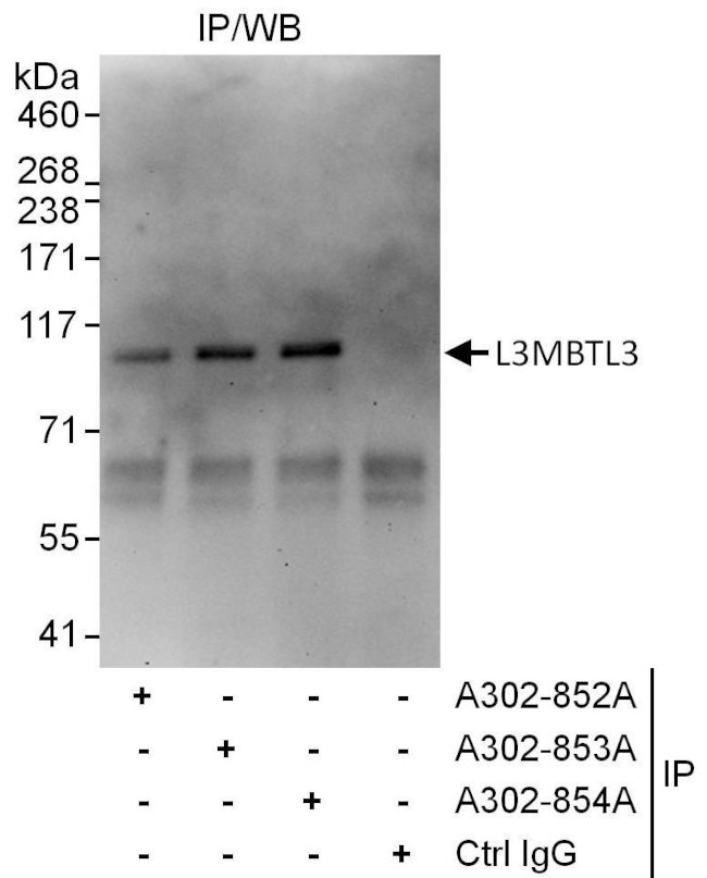 L3MBTL3 Antibody in Immunoprecipitation (IP)