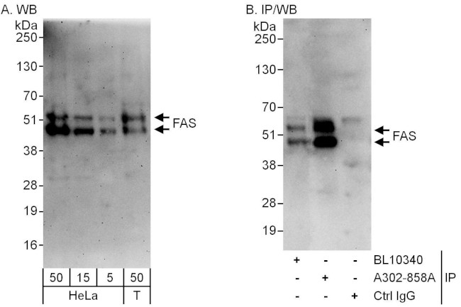 FAS Antibody in Western Blot (WB)