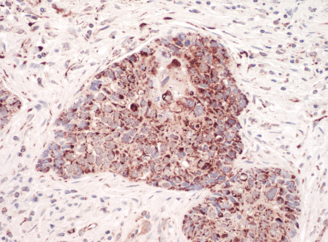 C1QBP Antibody in Immunohistochemistry (Paraffin) (IHC (P))