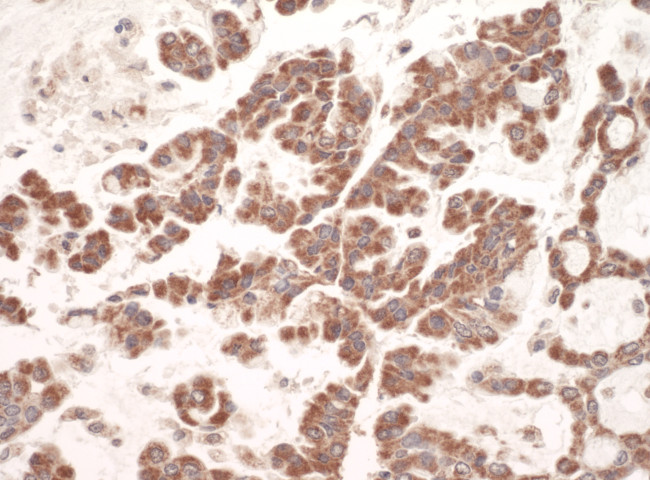 C1QBP Antibody in Immunohistochemistry (Paraffin) (IHC (P))