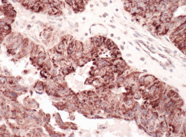 C1QBP Antibody in Immunohistochemistry (Paraffin) (IHC (P))