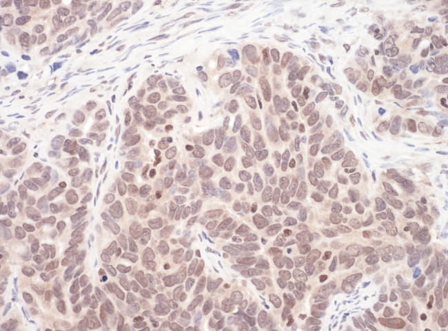 MAX Antibody in Immunohistochemistry (Paraffin) (IHC (P))
