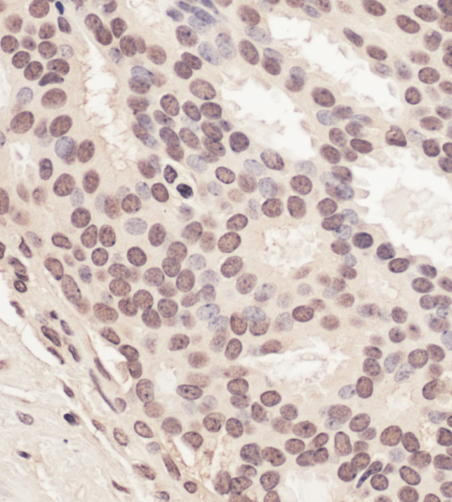 RNF2 Antibody in Immunohistochemistry (Paraffin) (IHC (P))