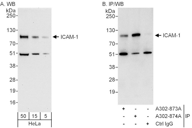 ICAM-1 Antibody in Western Blot (WB)