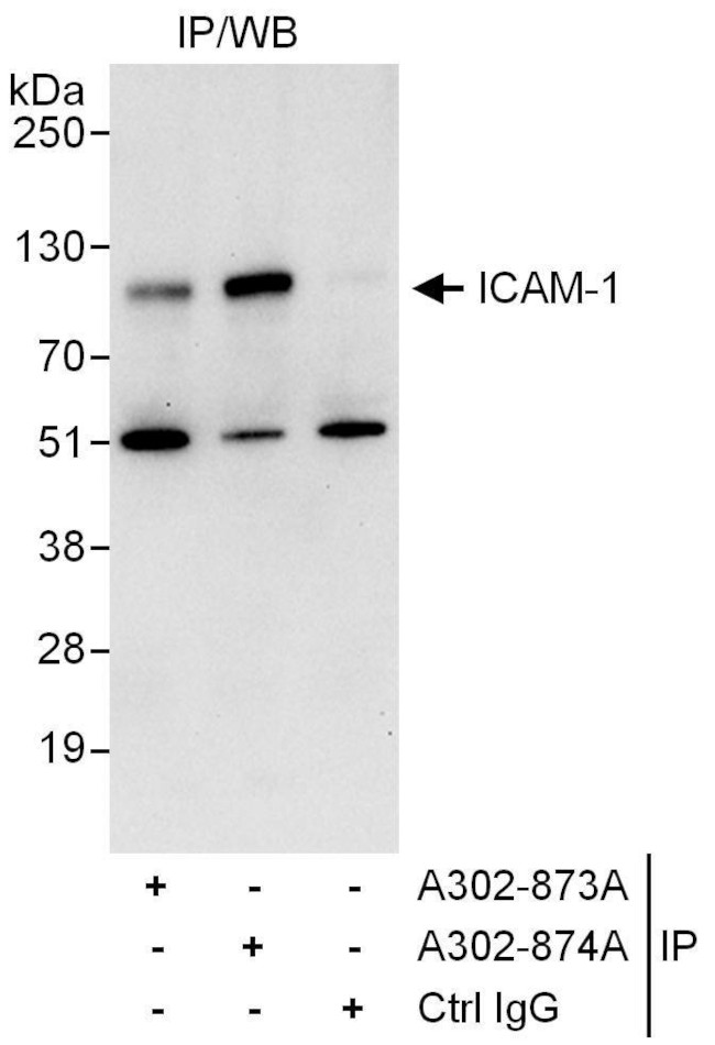 ICAM-1 Antibody in Immunoprecipitation (IP)