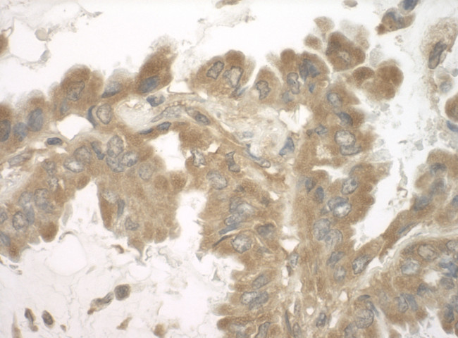 SND1 Antibody in Immunohistochemistry (Paraffin) (IHC (P))