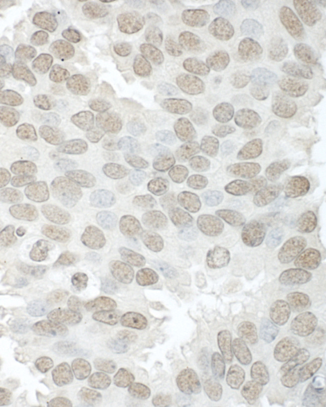 Aly Antibody in Immunohistochemistry (Paraffin) (IHC (P))