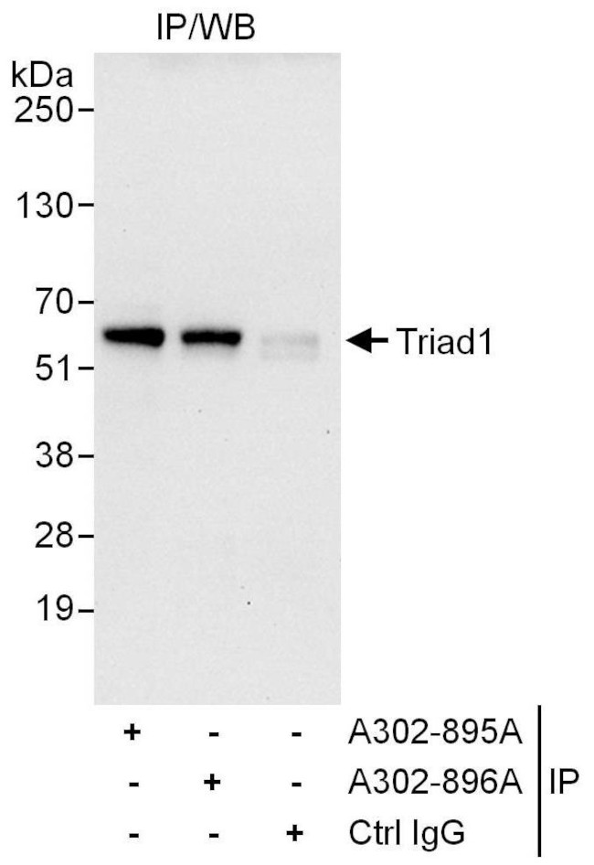 Triad1 Antibody in Immunoprecipitation (IP)