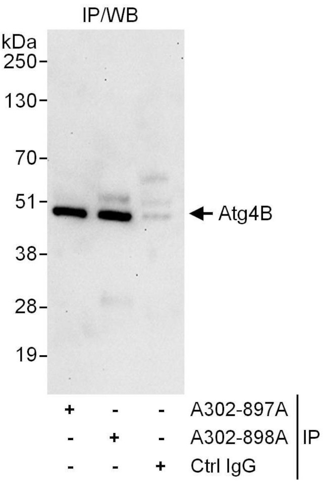 Atg4B Antibody in Immunoprecipitation (IP)